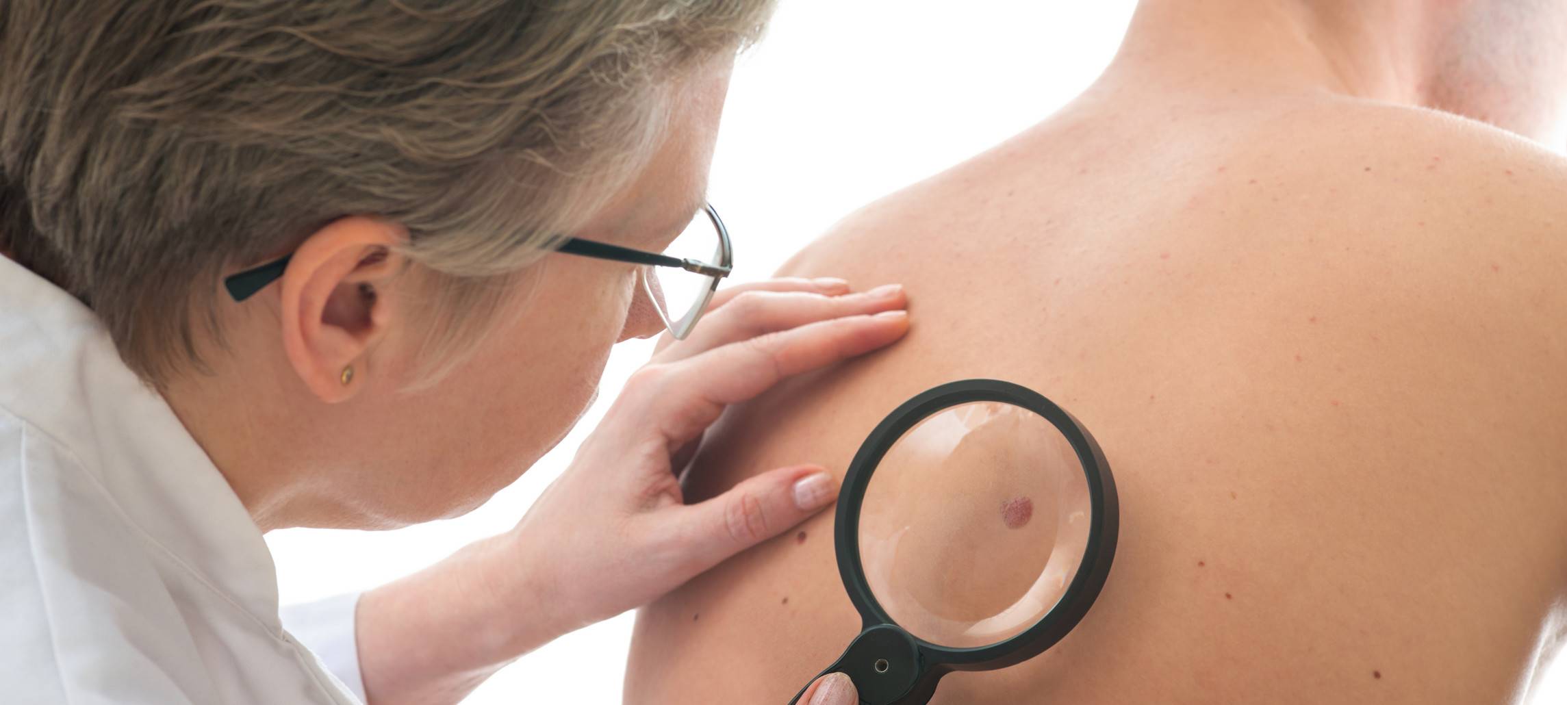 Nur Wenige gehen zur Hautkrebs-Vorsorge im Märkischen Kreis