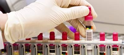 Corona-Inzidenzwert steigt wieder - weiterer Todesfall