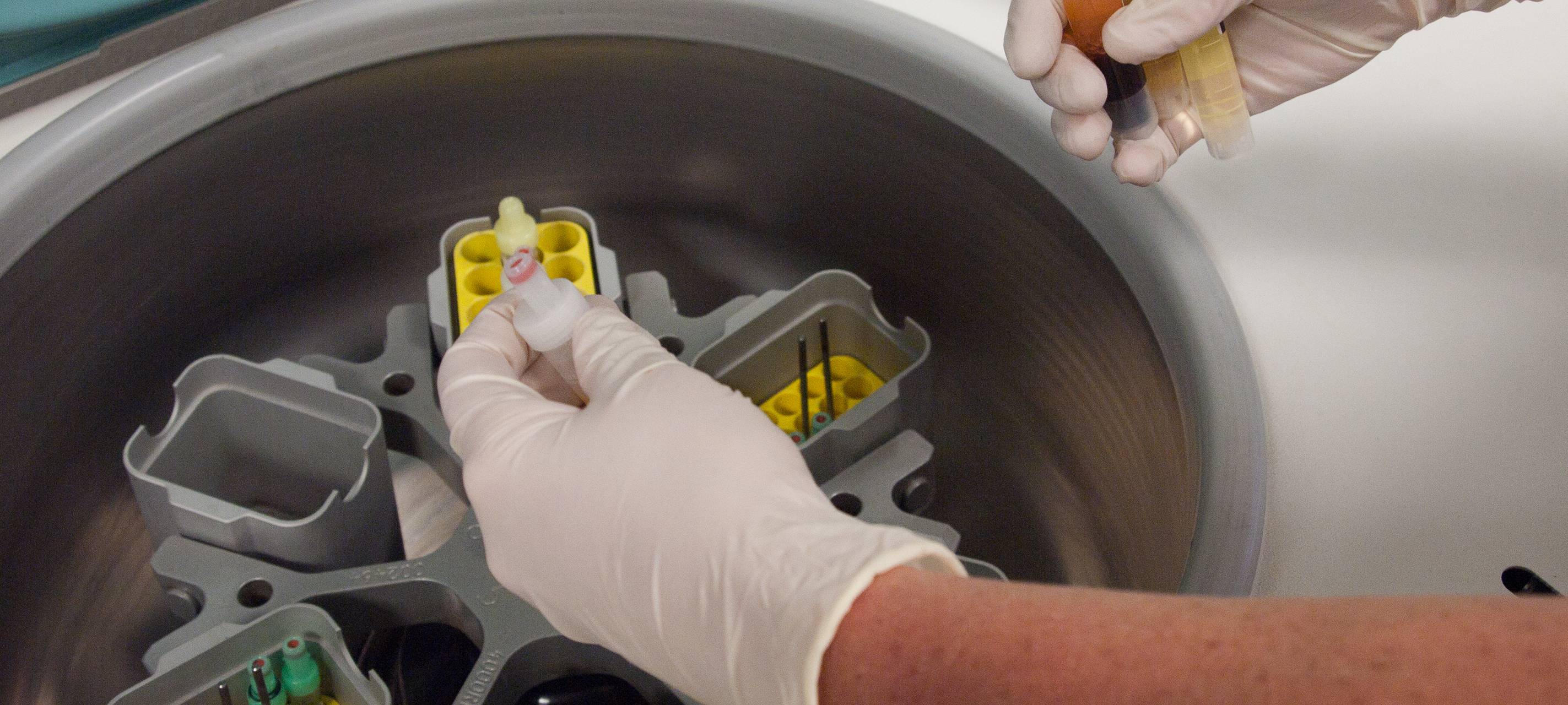 Labore arbeiten "am Anschlag"