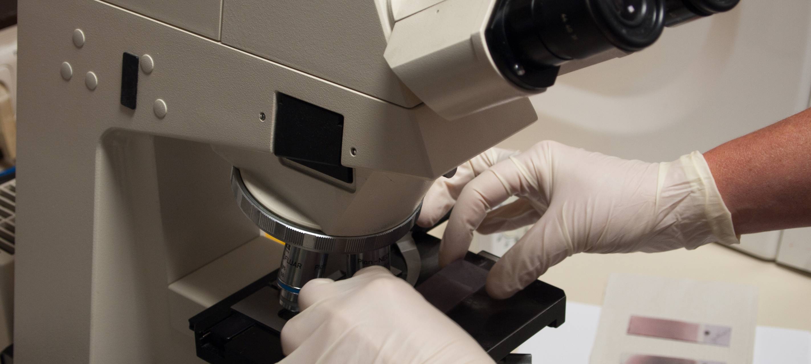 Erster bestätigter Corona-Fall im Kreis