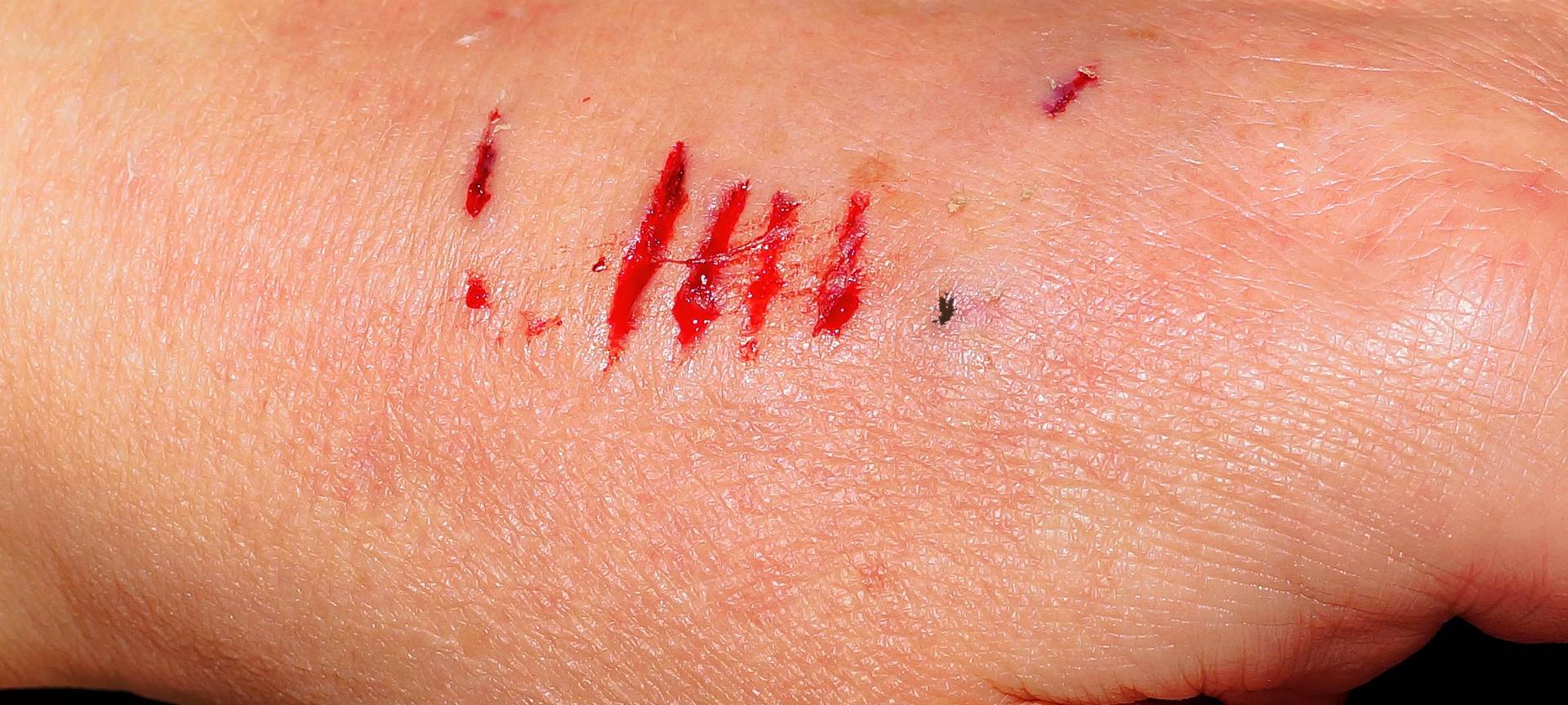 Haustierbiss sofort versorgen