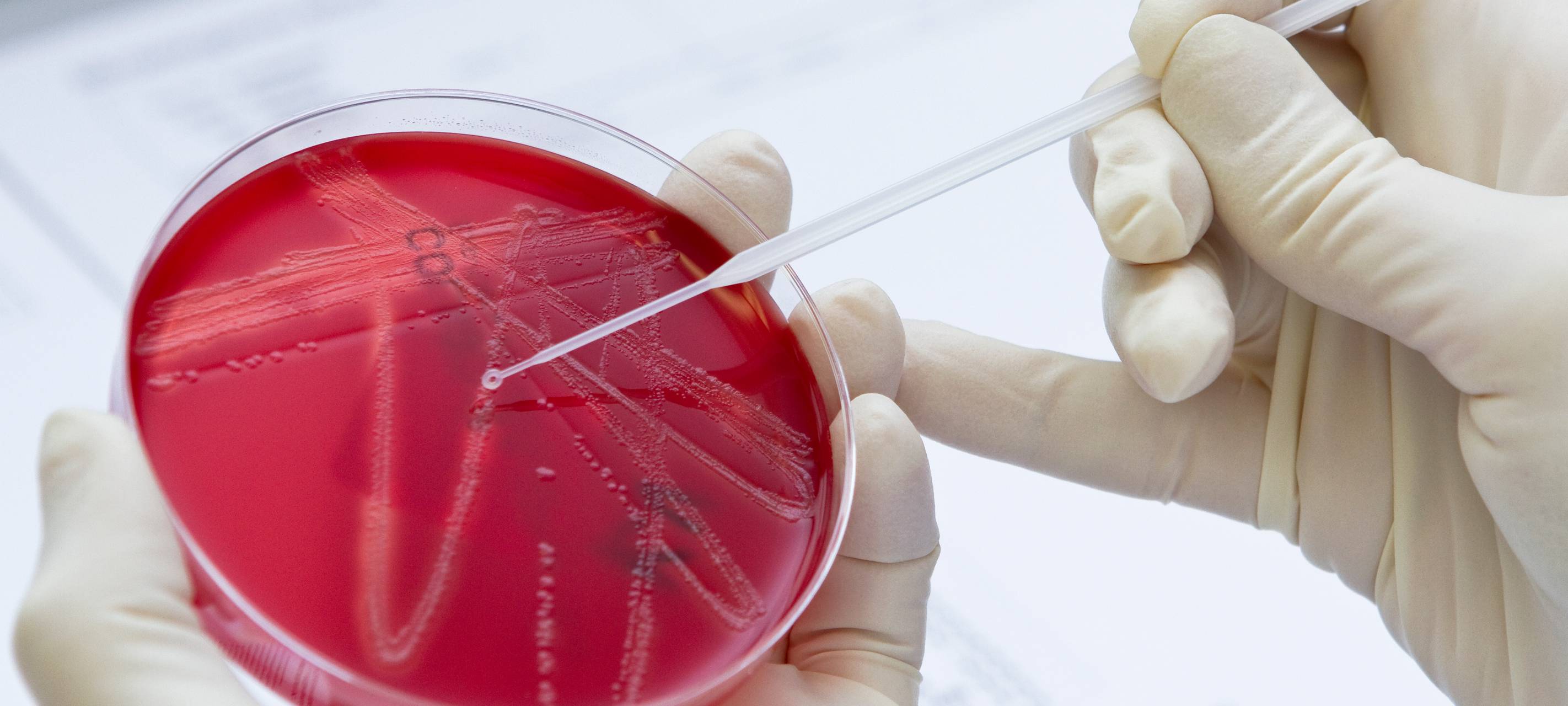 Petrischale im Labor