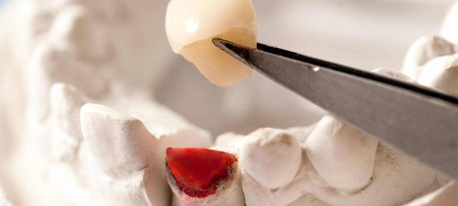 Weniger Zahnersatz im Märkischen Kreis