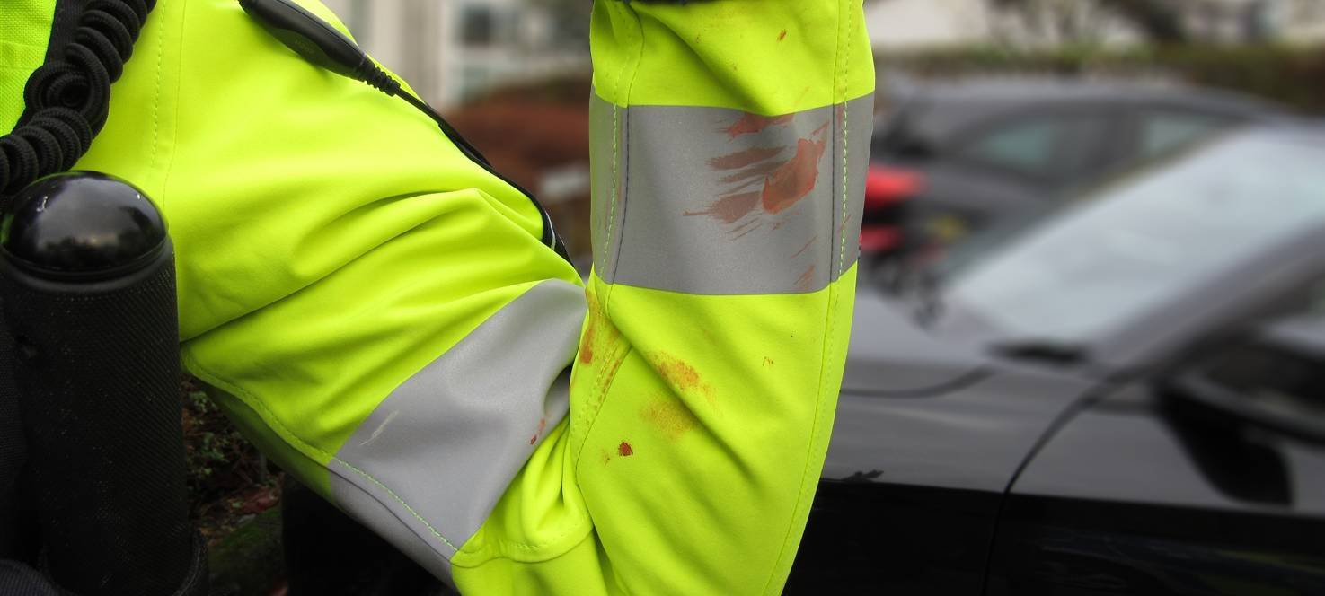 Die blutige Einsatzjacke der angegriffenen Beamtin.