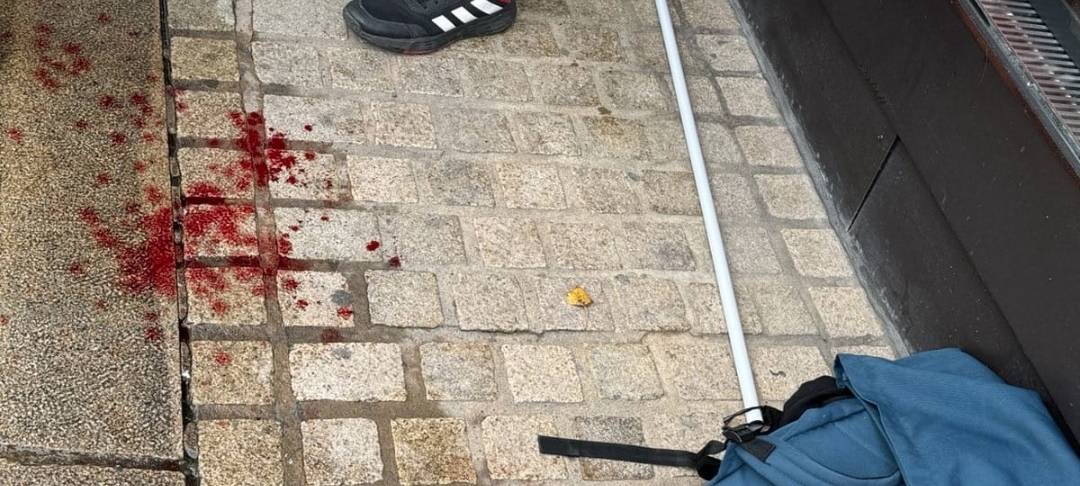 Rote Flecken von Blut auf dem Pflaster